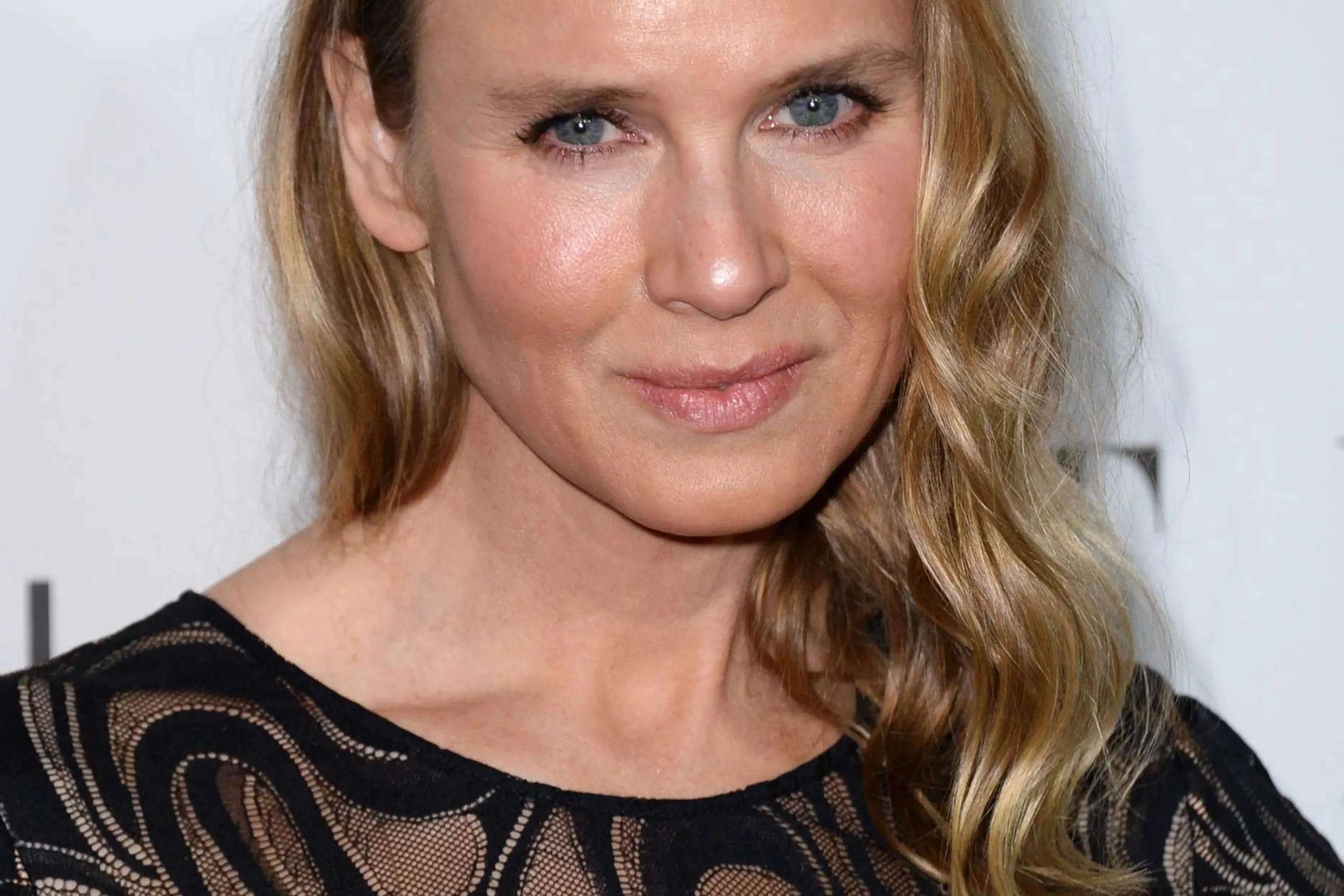 renee zellweger plastic surgery
